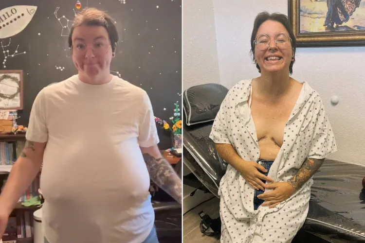 Жительница Флориды с седьмым размером груди Лайт рассказала об уменьшении груди