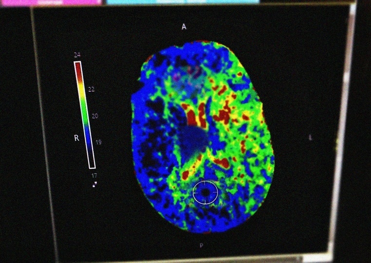 В Рязани прохожие помогли спасти женщину с инсультом